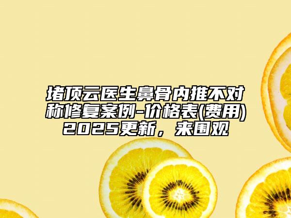 堵頂云醫(yī)生鼻骨內(nèi)推不對稱修復(fù)案例-價(jià)格表(費(fèi)用)2025更新，來圍觀