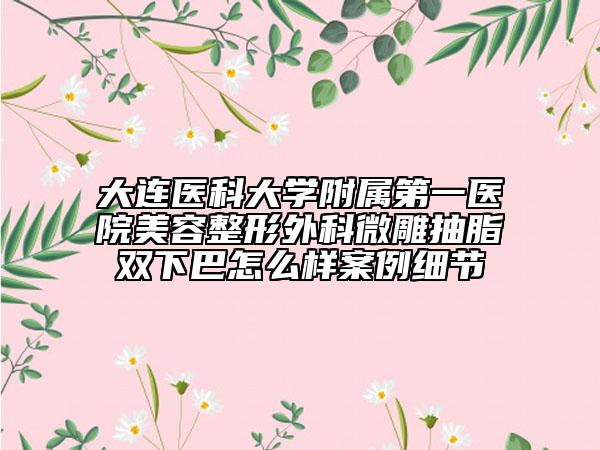 大連醫(yī)科大學(xué)附屬第一醫(yī)院美容整形外科微雕抽脂雙下巴怎么樣案例細(xì)節(jié)